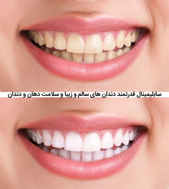 سابلیمینال فارسی دندان های سالم و زیبا و سلامت دهان و دندان