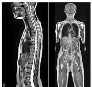 استخراج برش داده های MRI 3D با متلب