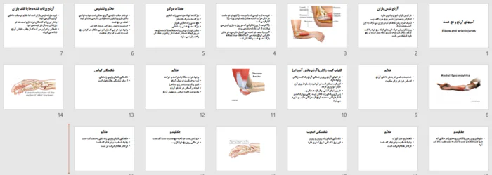 دانلود فایل پاورپوینت آسیب های آرنج و مچ دست