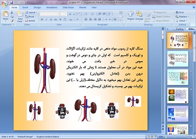دانلود پاورپوینت کلیه و سنگ کلیه