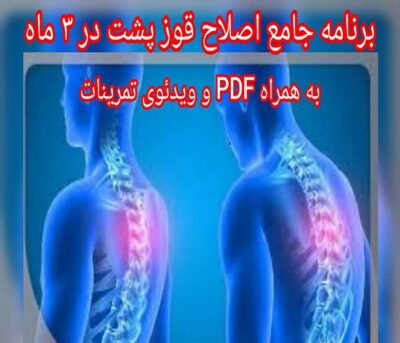 بسته جامع اصلاح قوز پشت در ۳ ماه (به همراه PDF و ویدئوی تمرینات)
