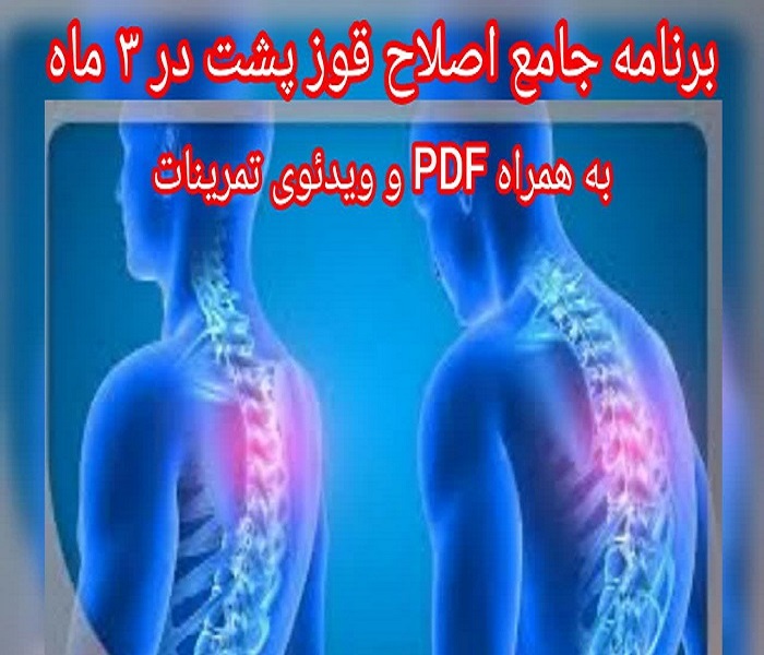 بسته جامع اصلاح قوز پشت در ۳ ماه (به همراه PDF و ویدئوی تمرینات)