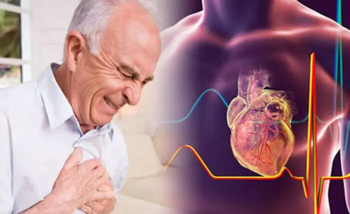 پاورپوینت درباره سکته قلبی
