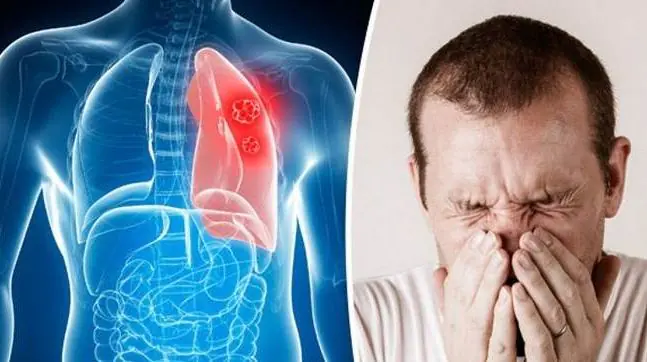 پاورپوینت درباره بیماریهای تنفسی